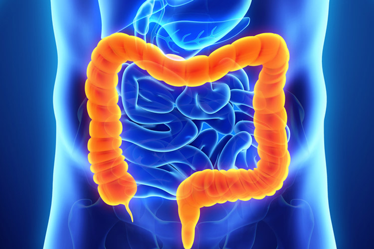 Tumore del colon-retto metastatico BRAF V600E: il regime con encorafenib aumenta significativamente i tassi di risposta