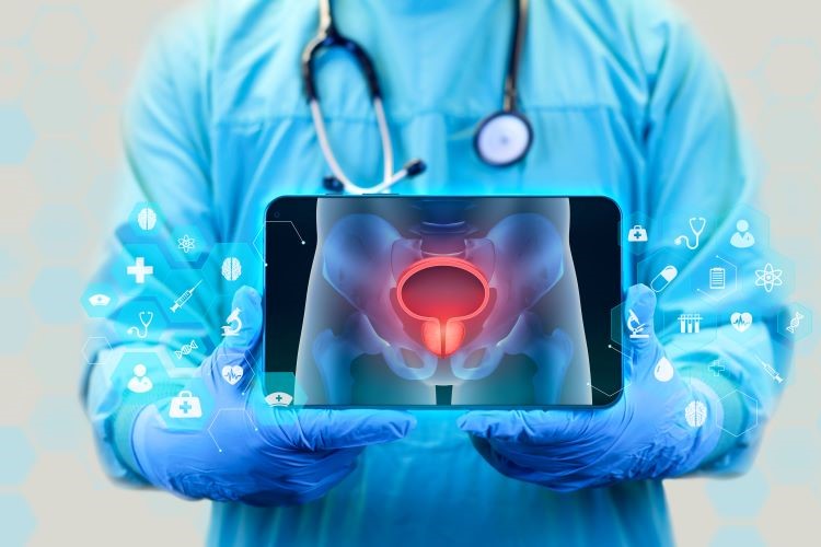 Carcinoma uroteliale avanzato HER2+, con disitamab vedotin pi� toripalimab in prima linea rischio di progressione ridotto del 64%. #ESMO25